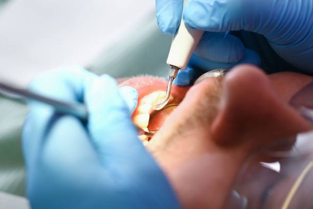 Best Emergency Dental Care for Trauma or Injury in Forestbrook, SC