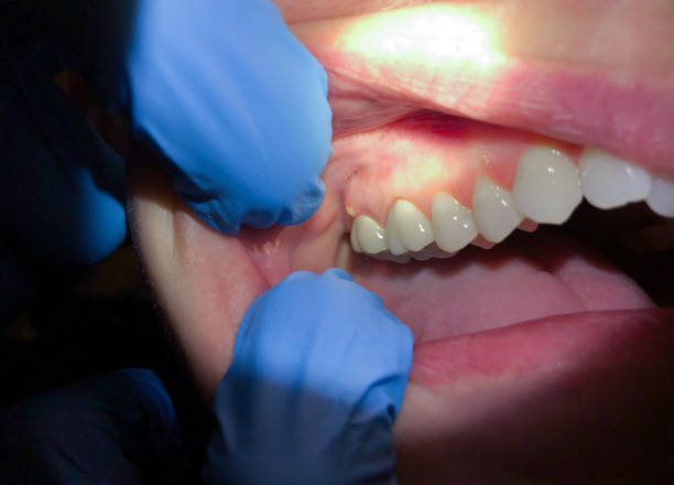 Best Emergency Dental Surgery in Forestbrook, SC